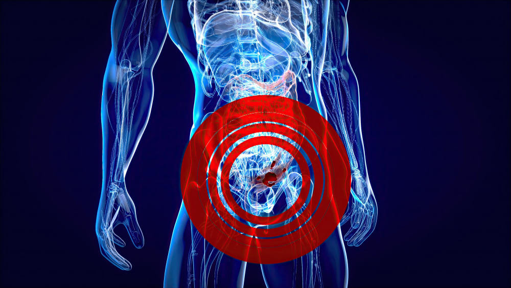 Resección transuretral de tumor vesical en León de los Aldama, Gto.: Tratamiento urológico especializado para la salud de la vejiga