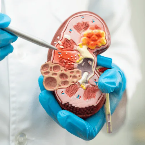 Especialista en Hiperplasia Prostática en León